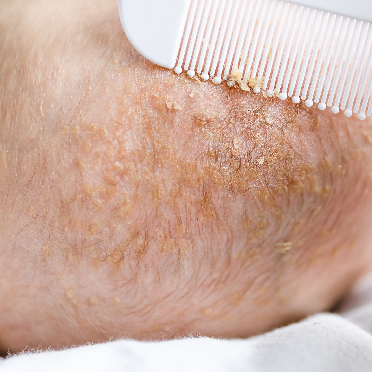 Baby Comb with Rounded Tips & Baby Hair Brush with Natural Bristles, (White & Blue)